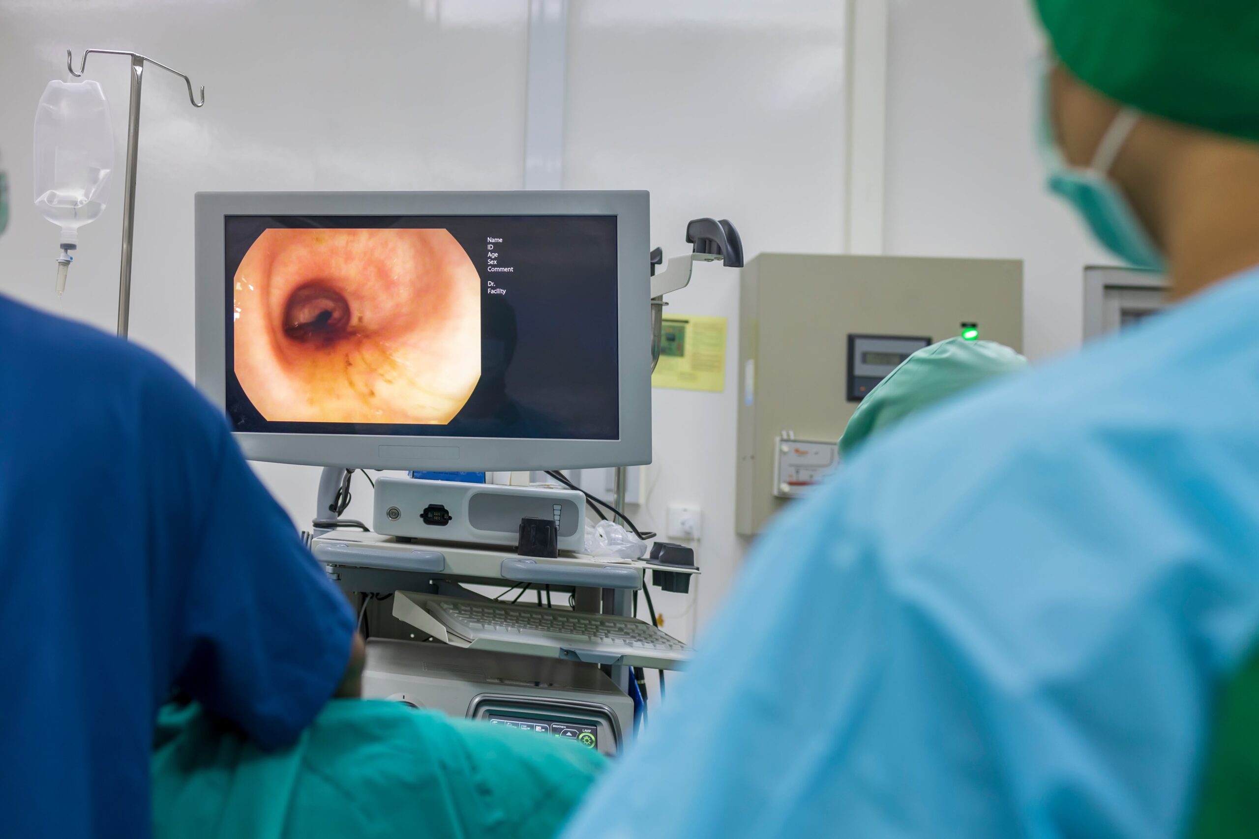 Medical professionals watching a monitor showing a colon endoscopy image during a procedure in a sterile clinical environment.